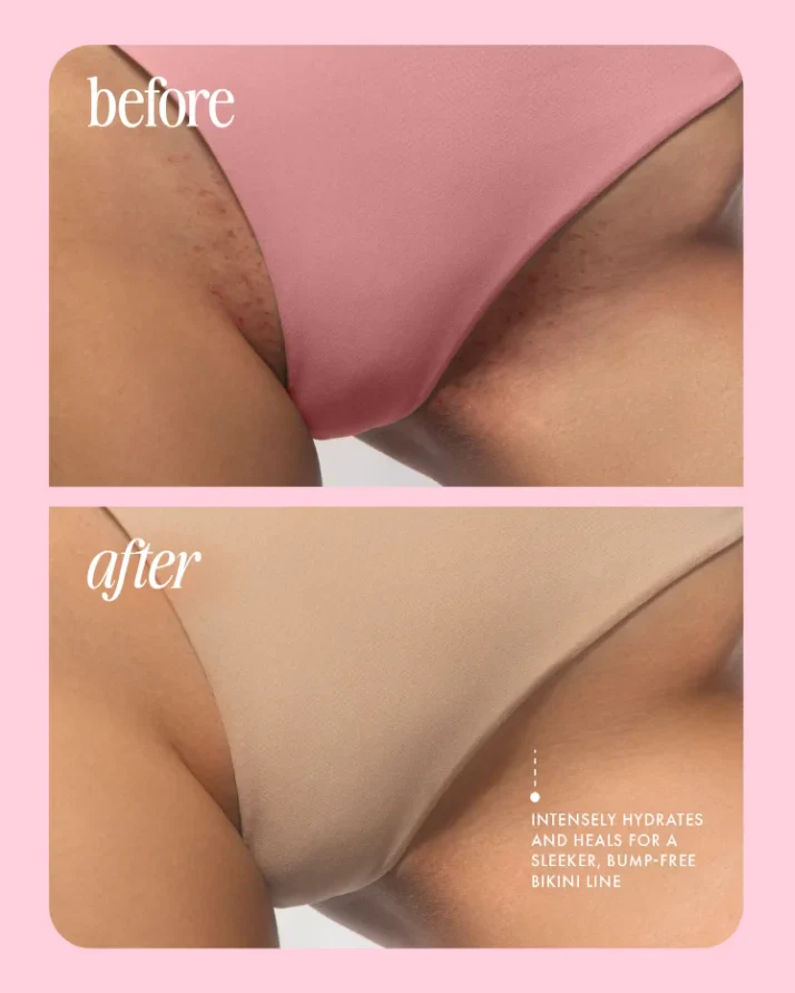 ⚡️ 5-Second Post-Hair Removal Rescue: Bumps Fade, Skin Glows! Glass Smooth Oil.⚡️Limited-Time Surprise Offer · Exclusive Perks for the First 100 Orders⚡️