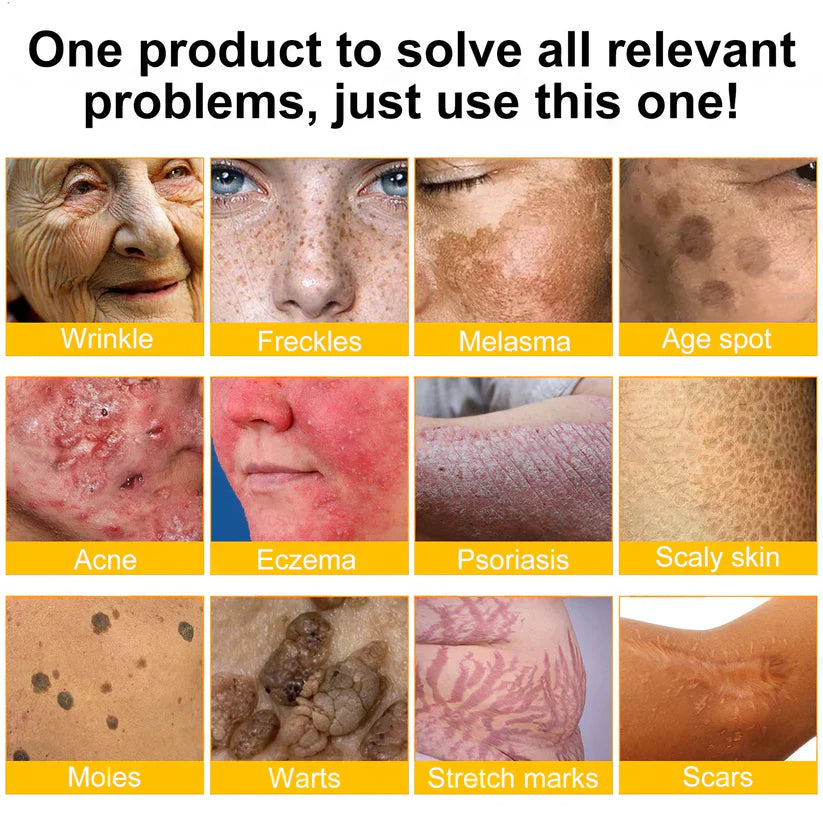 🔥FDA Approved: NESLEMY® Bee venom Pro Comprehensive Cream — 🔥Limited Time 80% OFF🔥