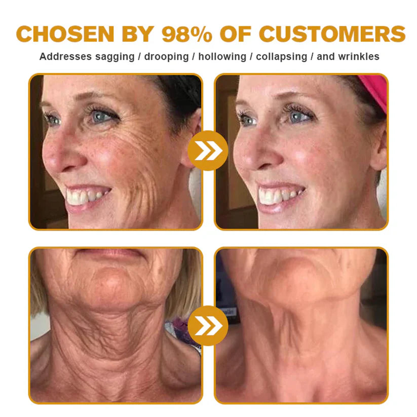 🔥FDA Approved: NESLEMY® Bee venom Pro Comprehensive Cream — 🔥Limited Time 80% OFF🔥
