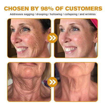 🔥FDA Approved: NESLEMY® Bee venom Pro Comprehensive Cream — 🔥Limited Time 80% OFF🔥