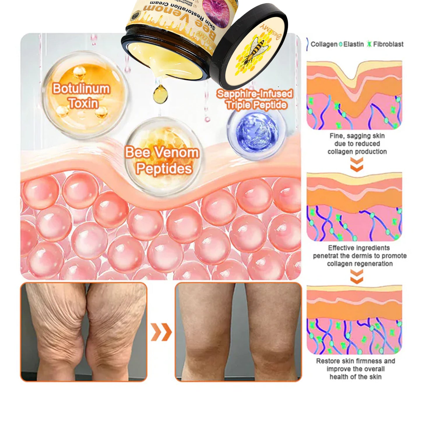 🔥FDA Approved: NESLEMY® Bee venom Pro Comprehensive Cream — 🔥Limited Time 80% OFF🔥