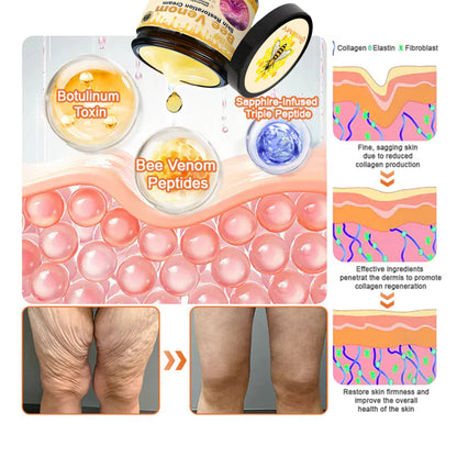 🔥FDA Approved: NESLEMY® Bee venom Pro Comprehensive Cream — 🔥Limited Time 80% OFF🔥