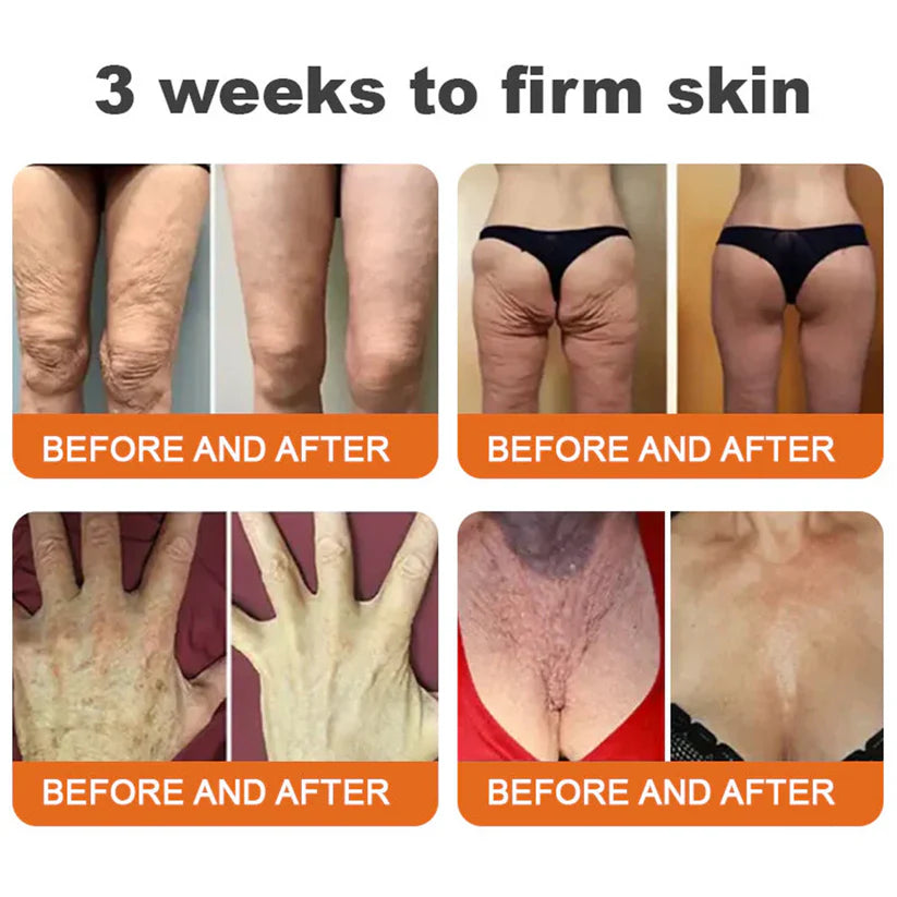 🔥FDA Approved: NESLEMY® Bee venom Pro Comprehensive Cream — 🔥Limited Time 80% OFF🔥