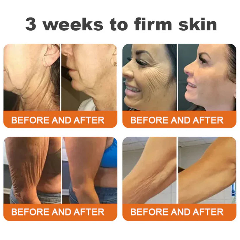 🔥FDA Approved: NESLEMY® Bee venom Pro Comprehensive Cream — 🔥Limited Time 80% OFF🔥