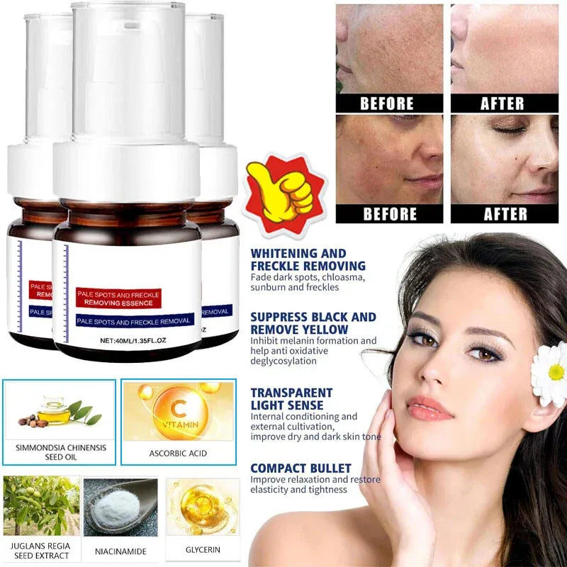 ⚡5-second brightening rescue: Dark spots disappear, blemishes fade, and skin becomes radiant! Vitamin C Whitening Freckles ESSENCE(3 HOURS LEFT!)