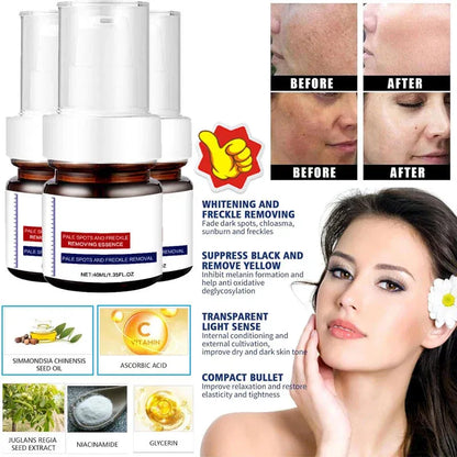 ⚡5-second brightening rescue: Dark spots disappear, blemishes fade, and skin becomes radiant! Vitamin C Whitening Freckles ESSENCE(3 HOURS LEFT!)