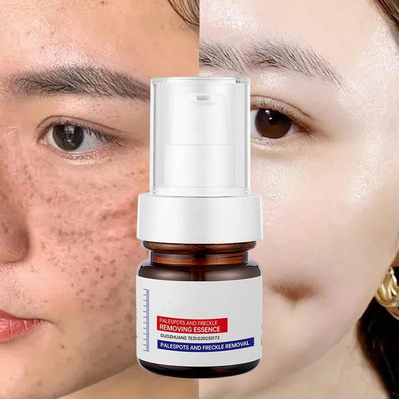 ⚡5-second brightening rescue: Dark spots disappear, blemishes fade, and skin becomes radiant! Vitamin C Whitening Freckles ESSENCE(3 HOURS LEFT!)